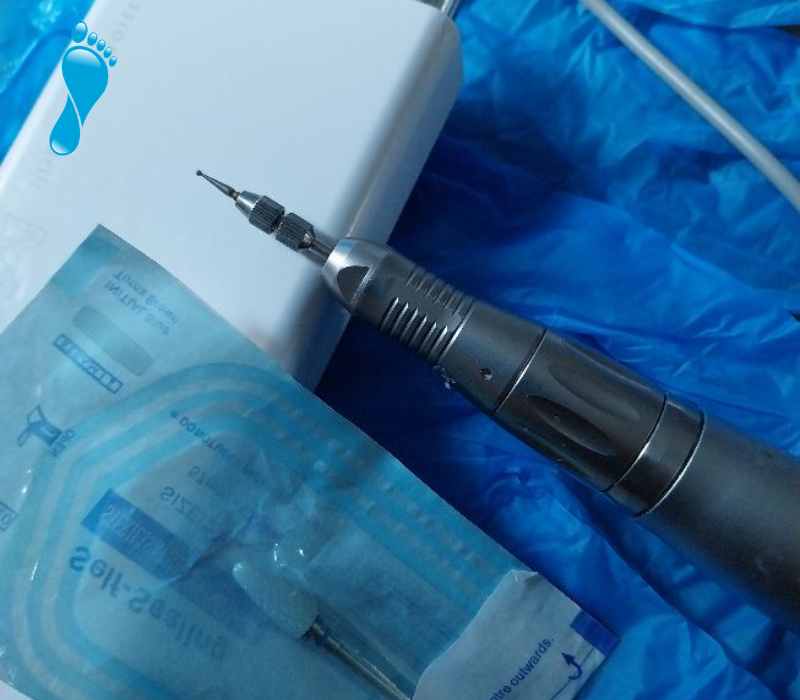 Fungal Nail Treatment - Jo Penny Foot Health